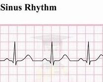 Sinus Rhythm Logo